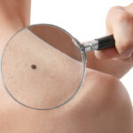 ほくろ占い｜体の部位ごとのほくろの意味や運勢【最強のほくろの位置はどこ？！】